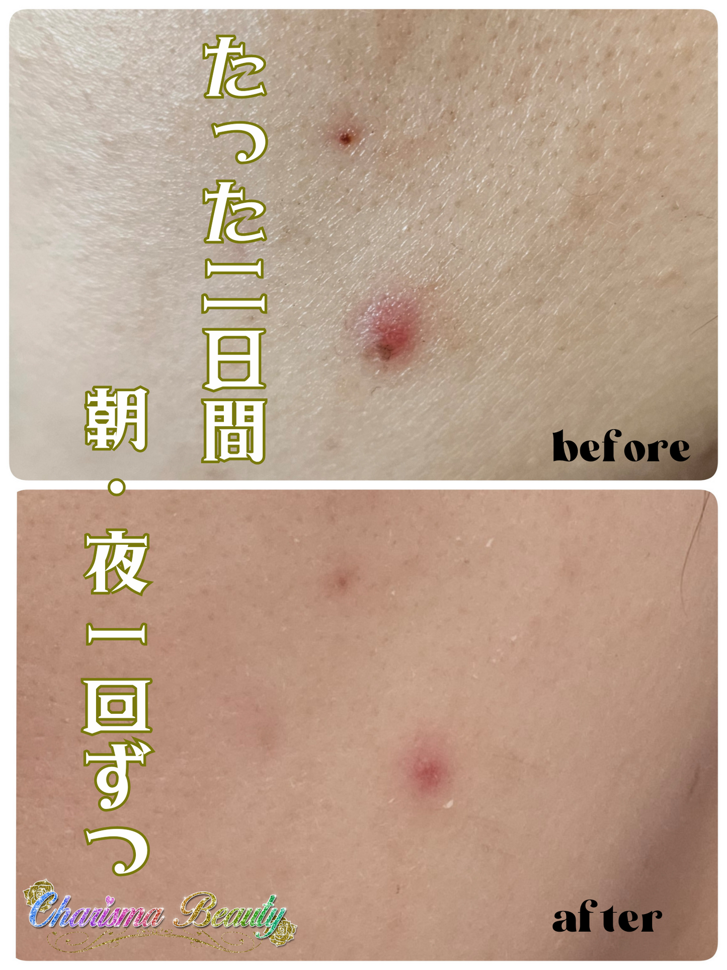 ダーマショットセラム(400shot)