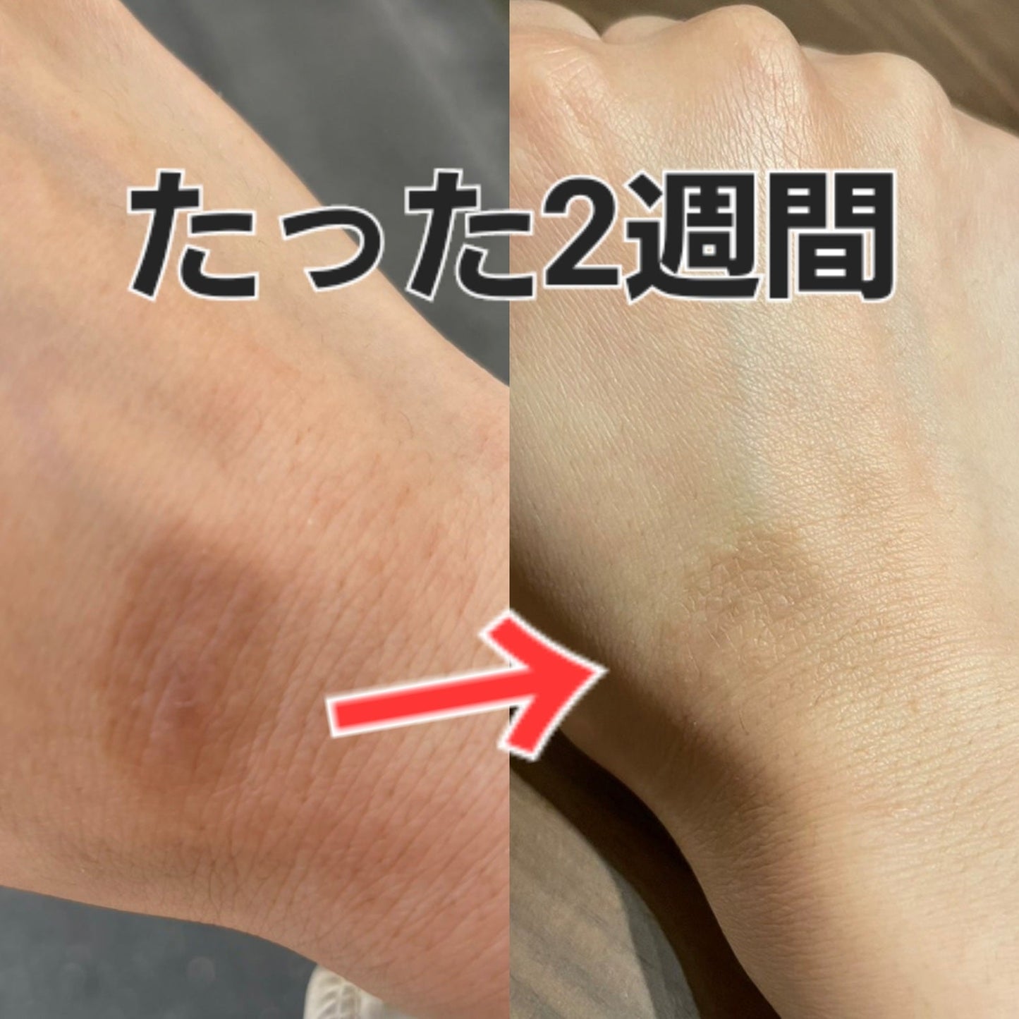 Cysay因子ボディローション(150ml)