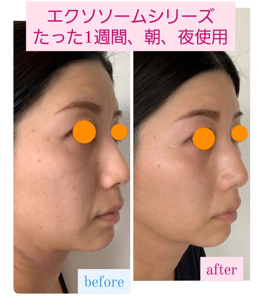 Reviエクソソーム モイストエッセンス(50ml)【ブースター】