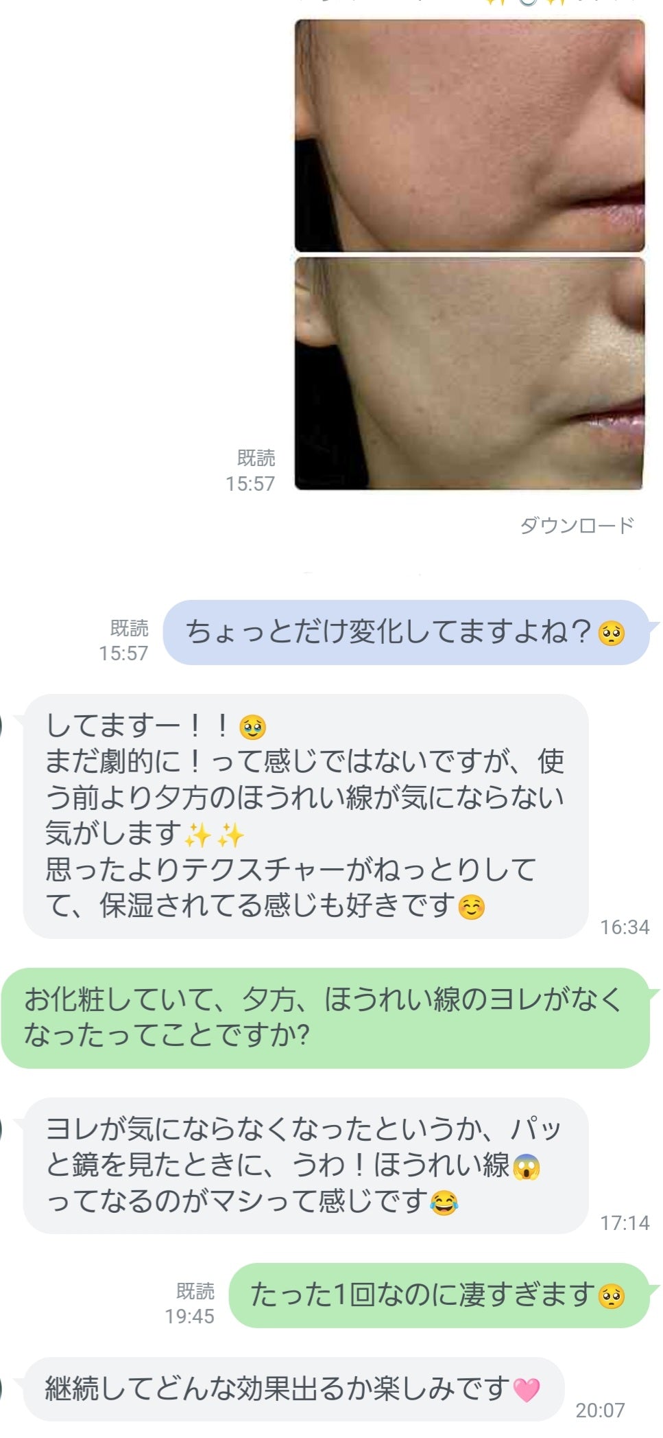 ダーマショットセラム(400shot)