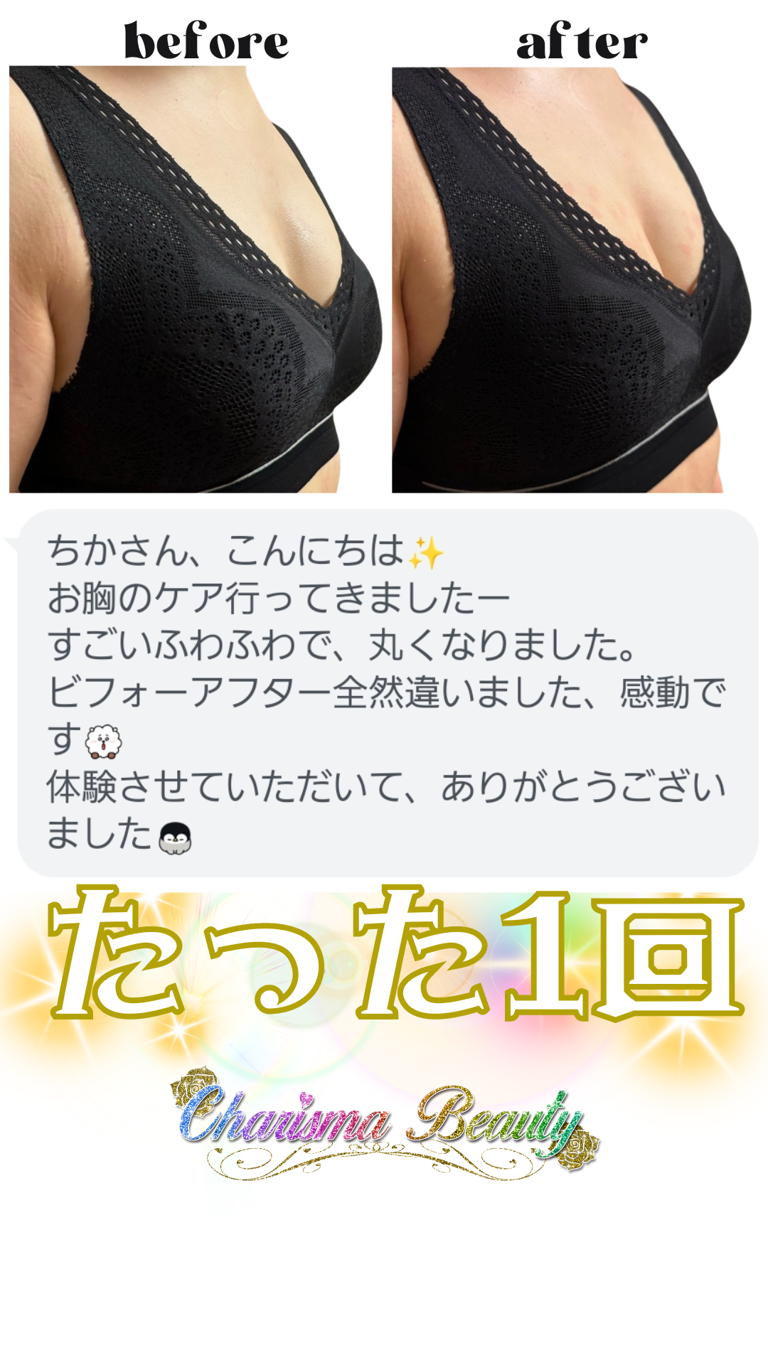 打つ水素 高圧振動波 筋膜リリース