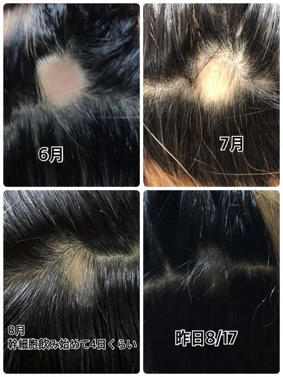 Revi CY PATCH 左右2枚×6セット(12枚入り)
