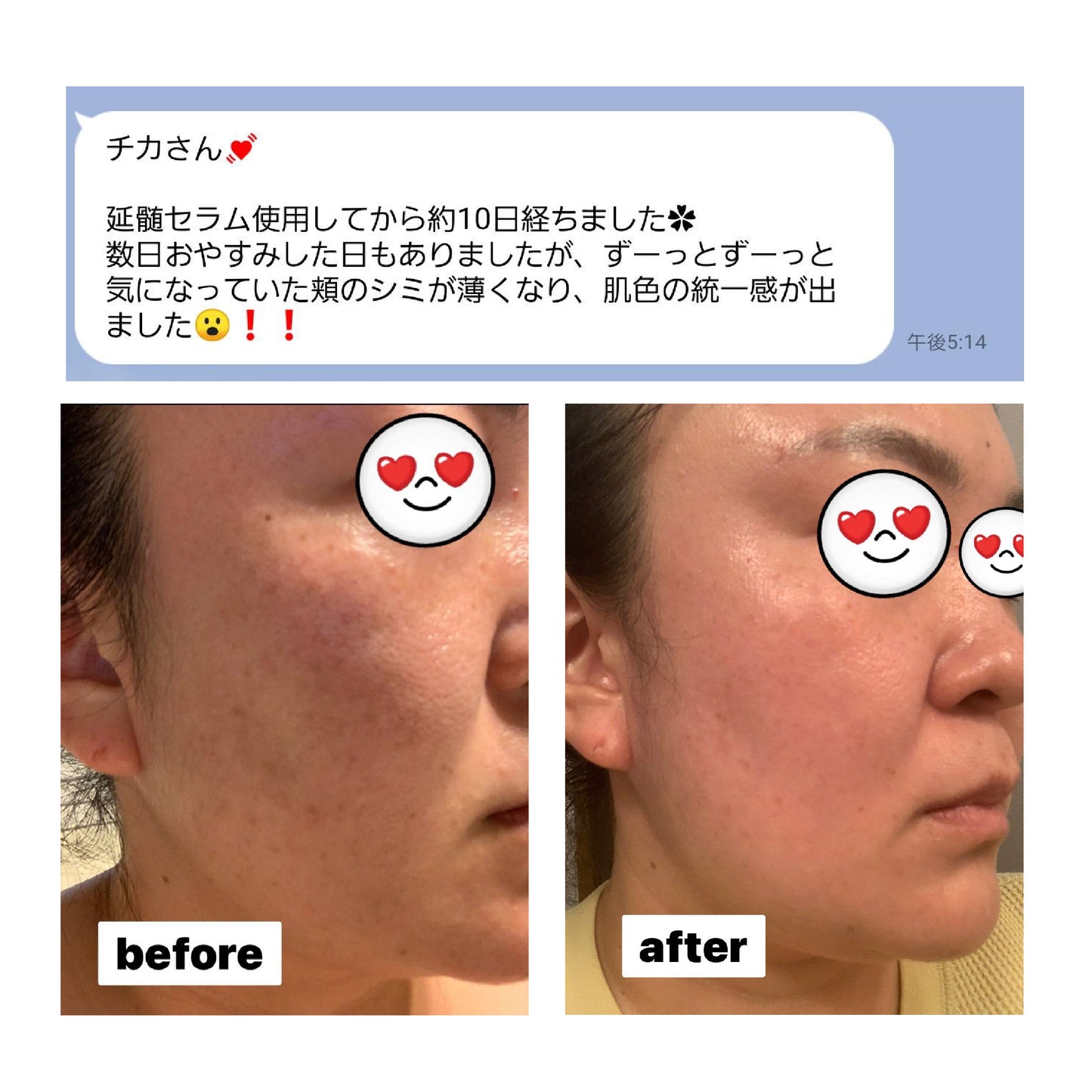 Revi陶肌セラム 30本