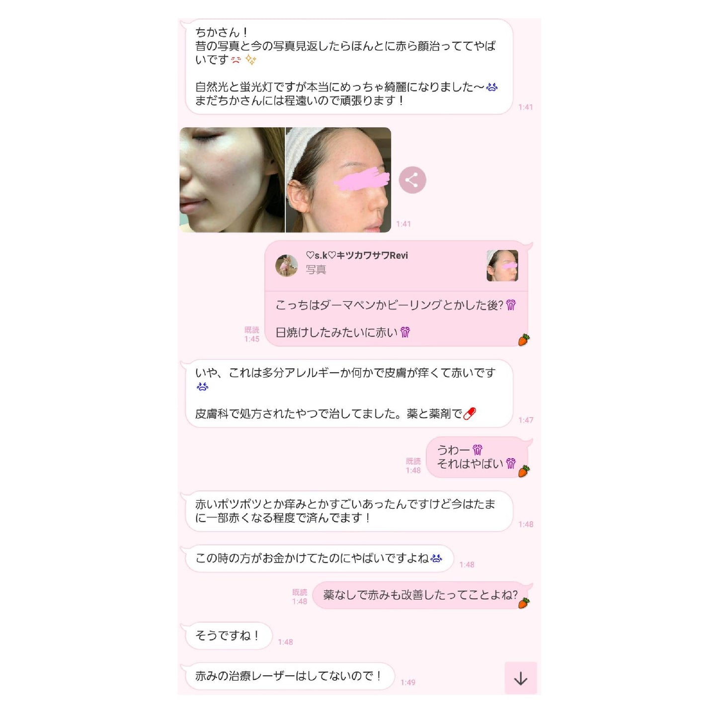 Reviモイスチャーパック
