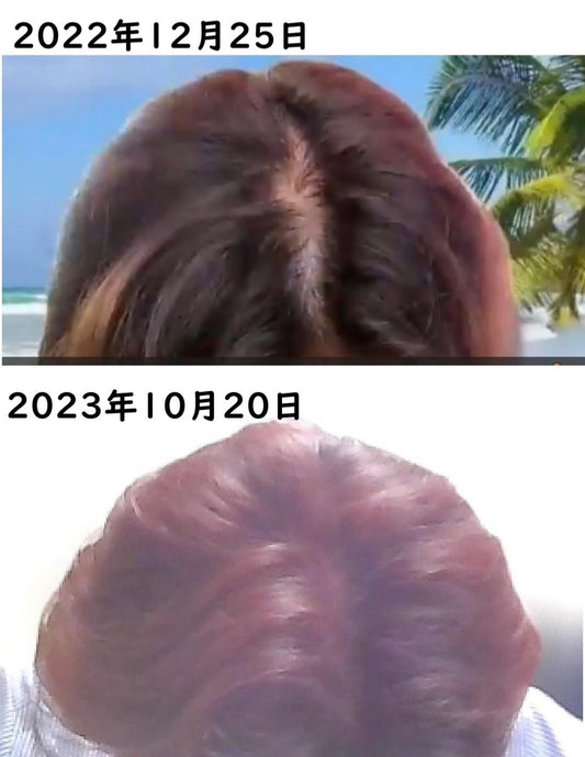 スカルプシャンプー 育毛、白髪予防(毛根幹細胞配合)500ml