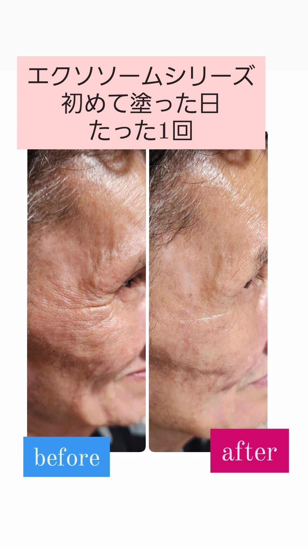 Reviエクソソーム モイストエッセンス(50ml)【ブースター】 – カリスマ