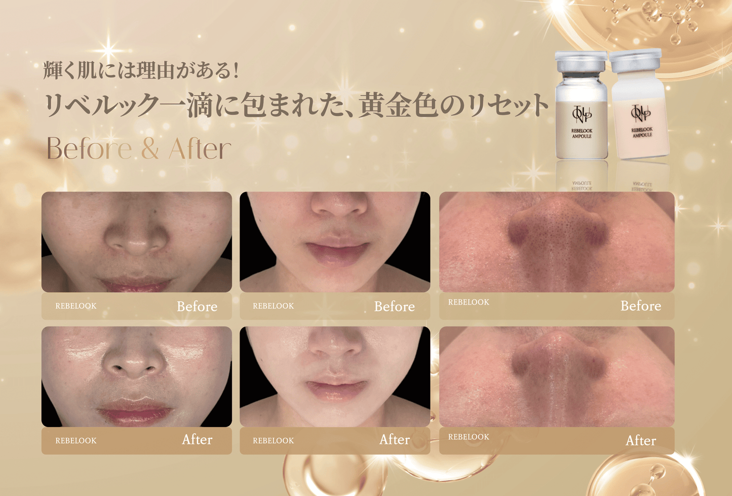 リベルック(単品)【正規契約店】