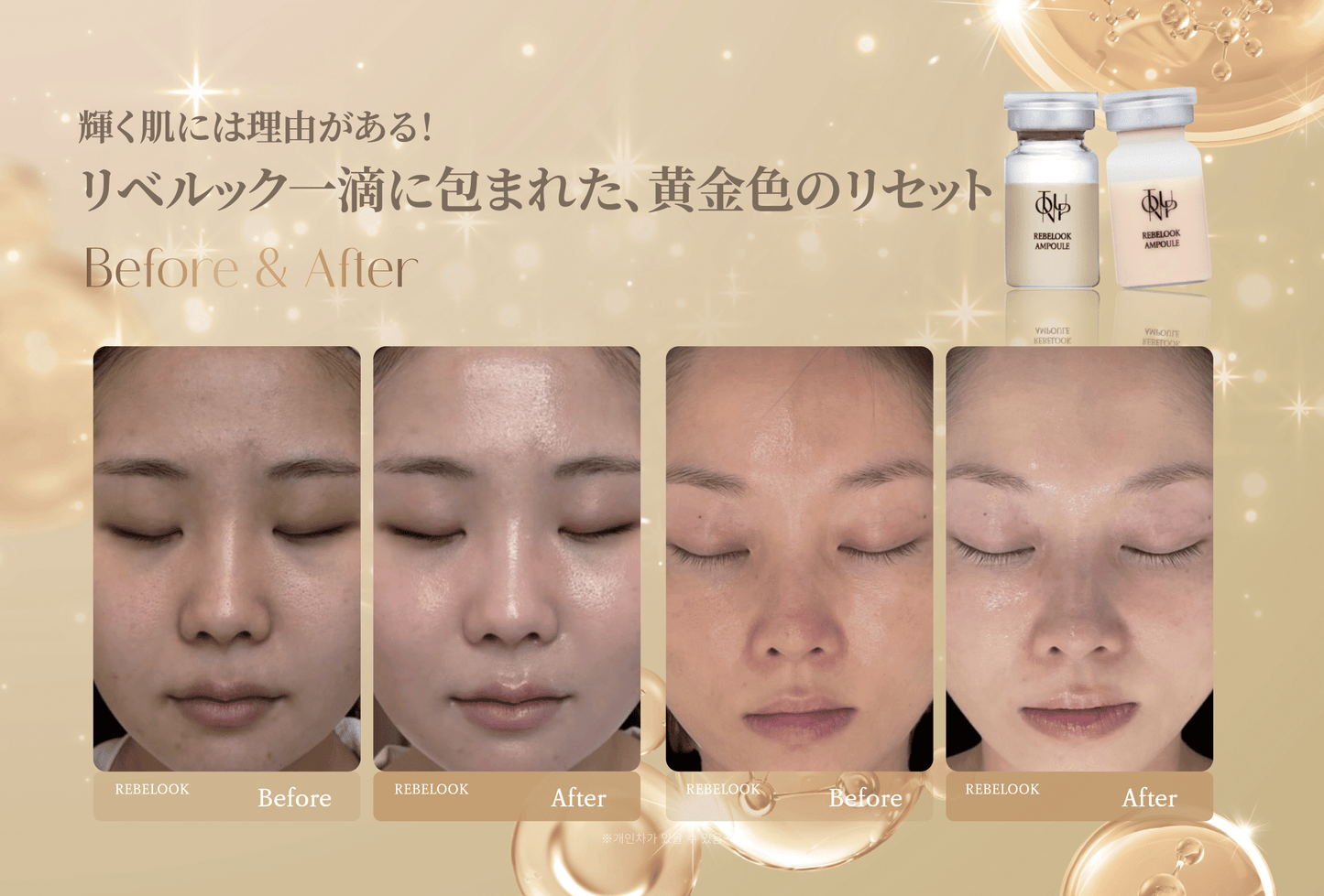 リベルック(単品)【正規契約店】