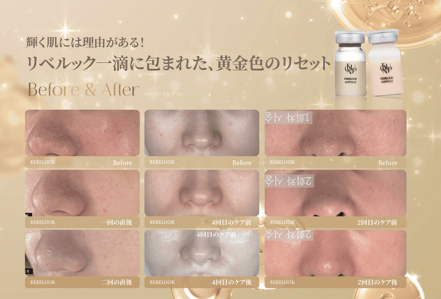 リベルック(単品)【正規契約店】
