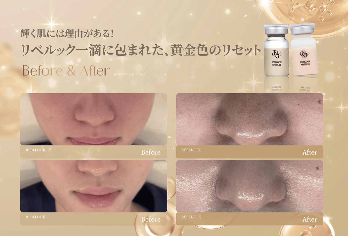 リベルック(単品)【正規契約店】