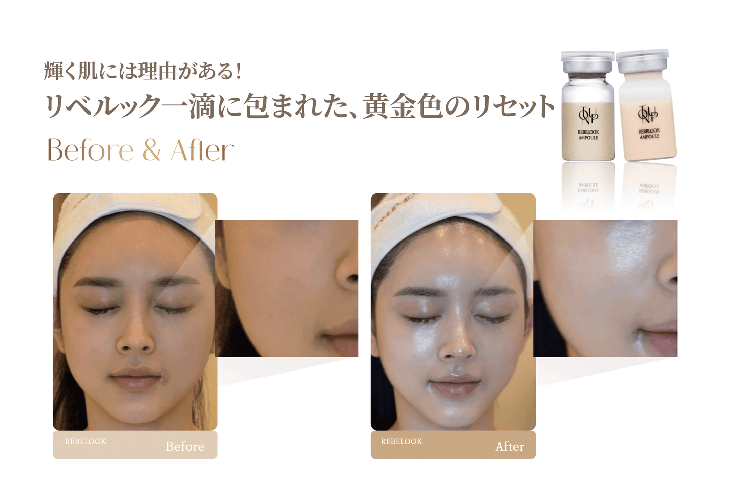 リベルック(単品)【正規契約店】